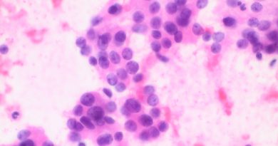 Letnia Szkoła Cytologii Tarczycy Letnia Szkoła Cytologii Tarczycy