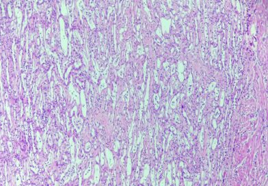Przypadek 357. Szkoły Młodych Patologów.